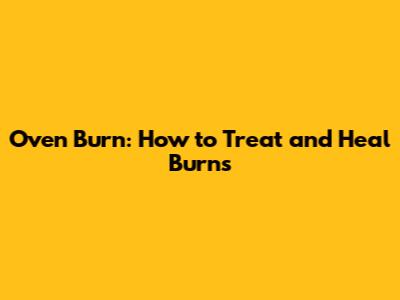 Oven Burn: How to Treat and Heal Burns
